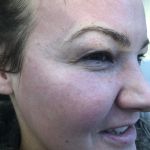 BB Glow Treatment