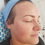 BB Glow Treatment