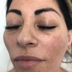 BB Glow Treatment